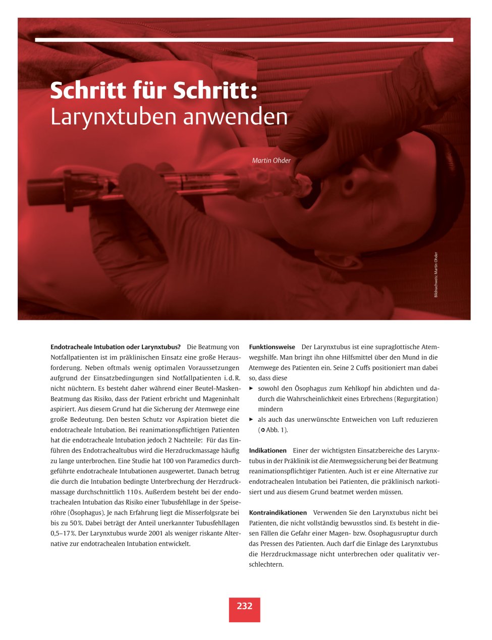 Vorschauseite 1: Schritt für Schritt: Larynxtuben anwenden