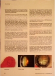 Vorschauseite 3: Grauer Star