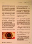 Vorschauseite 4: Grauer Star