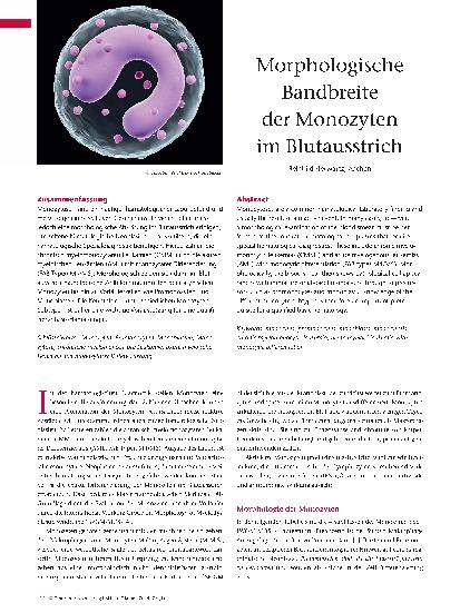 Vorschauseite 1: Morphologische Bandbreite der Monozyten im Blutausstrich