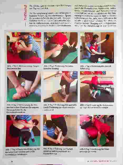 Vorschauseite 4: Neuroorthopädische Therapie bei hereditärer spastischer Paraplegie