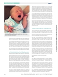 Vorschauseite 3: Schmerzen in der neonatologischen Intensivpflege präzise erfassen und einschätzen.