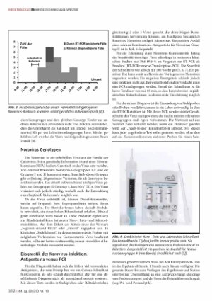 Vorschauseite 3: Norovirusinfektionen bei Kindern: Epidemiologie, Gang der Diagnostik und dringliche Erstmaßnahmen