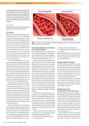 Vorschauseite 2: Herausforderung Beinulzera bei Sichelzellanämie: Erkennung, Beurteilung und Behandlung