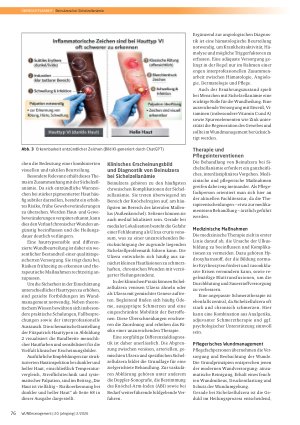 Vorschauseite 4: Herausforderung Beinulzera bei Sichelzellanämie: Erkennung, Beurteilung und Behandlung