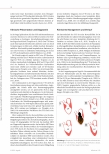 Vorschauseite 2: Das Takotsubo-Syndrom: Wenn das Herz vor lauter Stress nicht richtig pumpt.