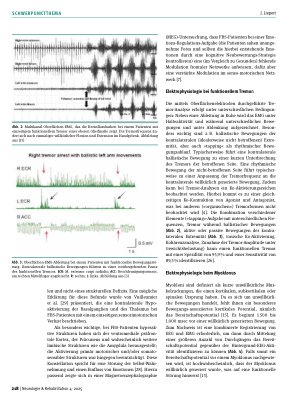Vorschauseite 3: Elektrophysiologie bei funktionellen Bewegungsstörungen