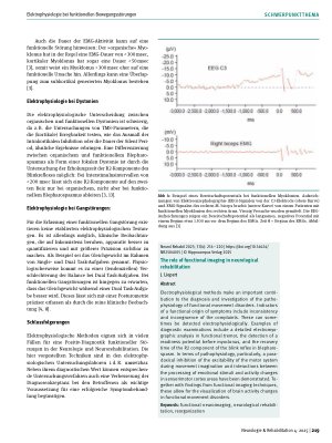 Vorschauseite 4: Elektrophysiologie bei funktionellen Bewegungsstörungen