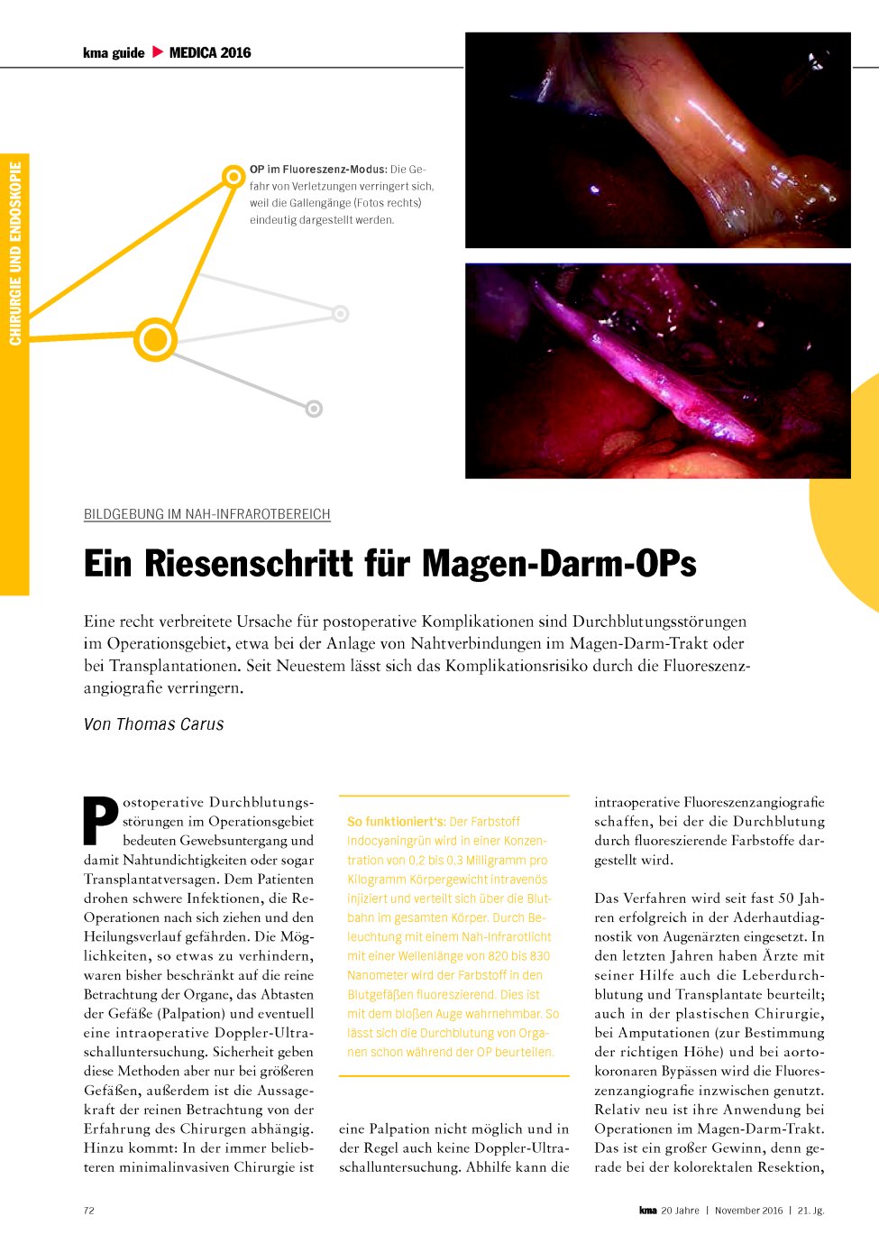 Vorschauseite 1: Bildgebung im Nah-Infrarotbereich: Ein Riesenschritt für Magen-Darm-OPs