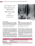 Vorschauseite 1: Anomalien und Normvarianten: Skelettale Veränderungen 3.15 Spina bifida occulta
