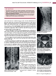 Vorschauseite 2: Anomalien und Normvarianten: Skelettale Veränderungen 3.15 Spina bifida occulta