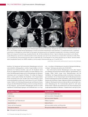 Vorschauseite 3: IgG4-assoziierte Erkrankungen Selten und oft spät diagnostiziert