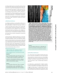 Vorschauseite 2: Der femoro-popliteale Bypass