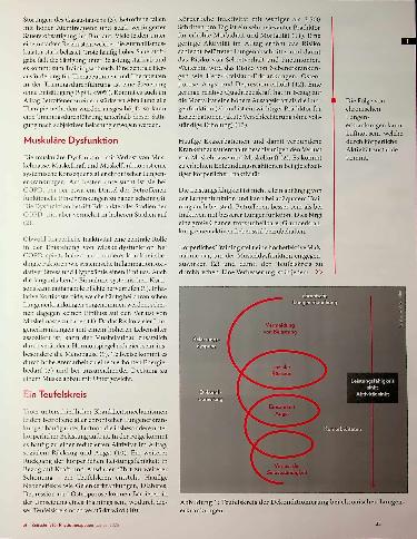 Vorschauseite 2: Teufelskreis der Dekonditionierung: Trainingstherapie bei chronischen Lungenerkrankungen