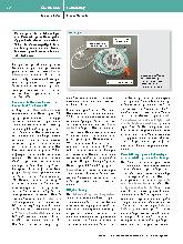 Vorschauseite 4: Wachkraniotomie -> Wachkraniotomie