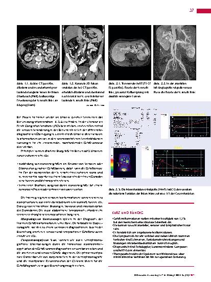 Vorschauseite 2: Anomalien und Normvarianten – Interne Veränderungen 2. 26: interne venöse Gefäßmalformation