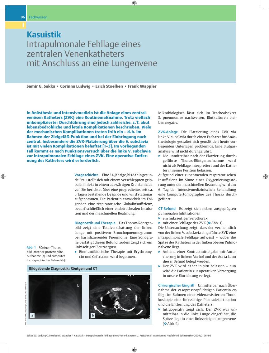 Vorschauseite 1: Kasuistik – Intrapulmonale Fehllage eines zentralen Venenkatheters mit Anschluss an eine Lungenvene