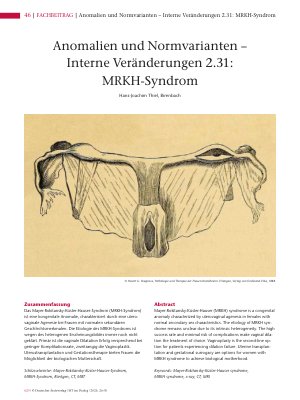 Vorschauseite 1: Anomalien und Normvarianten – Interne Veränderungen 2. 31: MRKH-Syndrom