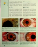Vorschauseite 4: Tumorerkrankungen - Augendiagnose und die Möglichkeit der Früherkennung