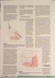 Vorschauseite 5: Stoma bei Patienten mit M. Crohn und Befall des Dickdarms und des Afters The corrected text is: Stoma bei Patienten mit M. Crohn und Befall des Dickdarms und des Afters