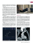 Vorschauseite 2: Lungenarterienembolie in der Computertomografie (Teil 2)