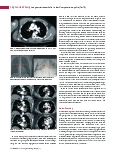Vorschauseite 3: Lungenarterienembolie in der Computertomografie (Teil 2)