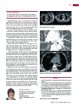 Vorschauseite 4: Lungenarterienembolie in der Computertomografie (Teil 2)