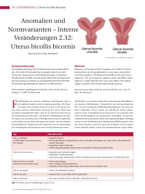 Vorschauseite 1: Anomalien und Normvarianten- Interne Veränderungen 2.32. Uterus bicollis bicornis