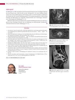 Vorschauseite 3: Anomalien und Normvarianten- Interne Veränderungen 2.32. Uterus bicollis bicornis