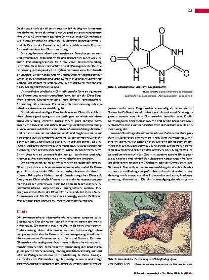 Vorschauseite 2: Gicht Pathogenese und Epidemiologie