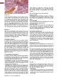 Vorschauseite 3: Myelodysplastische Syndrome (Teil 1)
