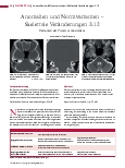 Vorschauseite 1: Anomalien und Normvarianten – Skelettale Veränderungen 3.12 Varianten des Processus mastoideus
