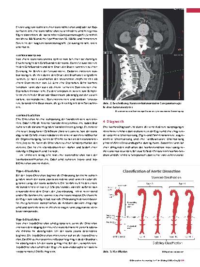 Vorschauseite 2: Das Marfan -Syndrom