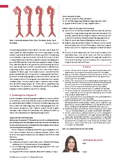 Vorschauseite 3: Das Marfan -Syndrom