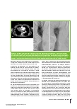 Vorschauseite 5: Interventionelle Onkologie Teil 2 – Ablative Verfahren und palliative Therapien