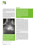 Vorschauseite 6: Interventionelle Onkologie Teil 2 – Ablative Verfahren und palliative Therapien