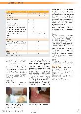 Vorschauseite 3: PFLEGELEXIKON - die Serie zum Sammeln Exsudatmanagement, Teil 2: Versorgungsoptionen
