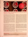Vorschauseite 3: PubMed-Update 10 2022 Kubitaltunnelsyndrom: Welche physiotherapeutischen Maßnahmen sind effektiv?