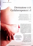 Vorschauseite 1: Dermatose mit Gefahrenpotential