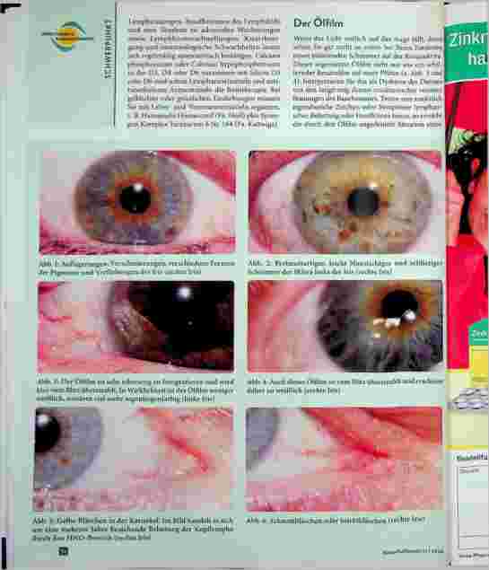Vorschauseite 2: Was verrät das Auge über Venen und Lymphe? Augendiagnose für Nichtaugendiagnostiker