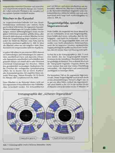 Vorschauseite 3: Was verrät das Auge über Venen und Lymphe? Augendiagnose für Nichtaugendiagnostiker