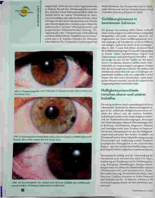 Vorschauseite 4: Was verrät das Auge über Venen und Lymphe? Augendiagnose für Nichtaugendiagnostiker