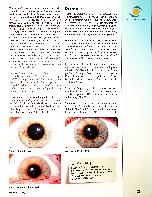 Vorschauseite 2: Irisdiagnose und Depression. Durch Irisdiagnostik lässt sich eine Depression zielgerichtet behandeln.