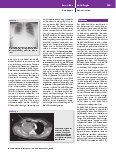 Vorschauseite 3: Patient mit Lungenabszess anstatt vermuteter COVID-19-Infektion