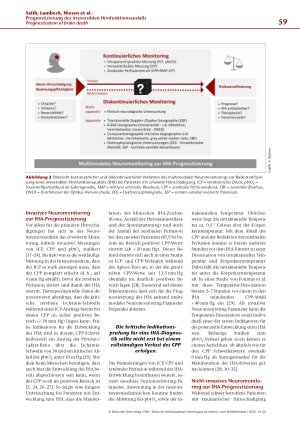 Vorschauseite 4: Prognostizierung des irreversiblen Hirnfunktionsausfalls