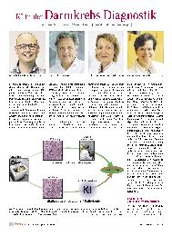 Vorschauseite 1: KI in der Darmkrebs-Diagnostik