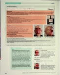 Vorschauseite 6: Stirnund Kinndekubitus bei beatmeten COVID-19-Patienten in Bauchlage - ein ungelöstes Problem?