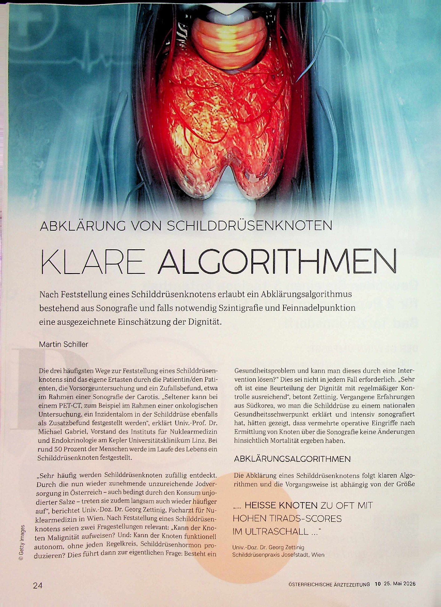 Vorschauseite 1: Abklärung von Schilddrüsenknoten. Klare Algorithmen