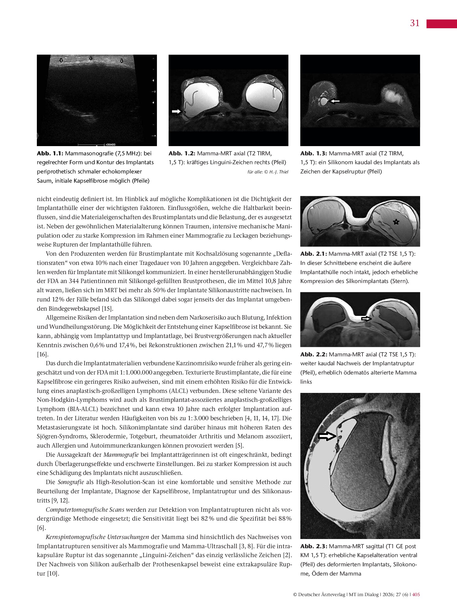 Vorschauseite 2: Anomalien und Normvarianten – Wieder einmal anders (Teil IV): Mamma-Implantat-Komplikationen