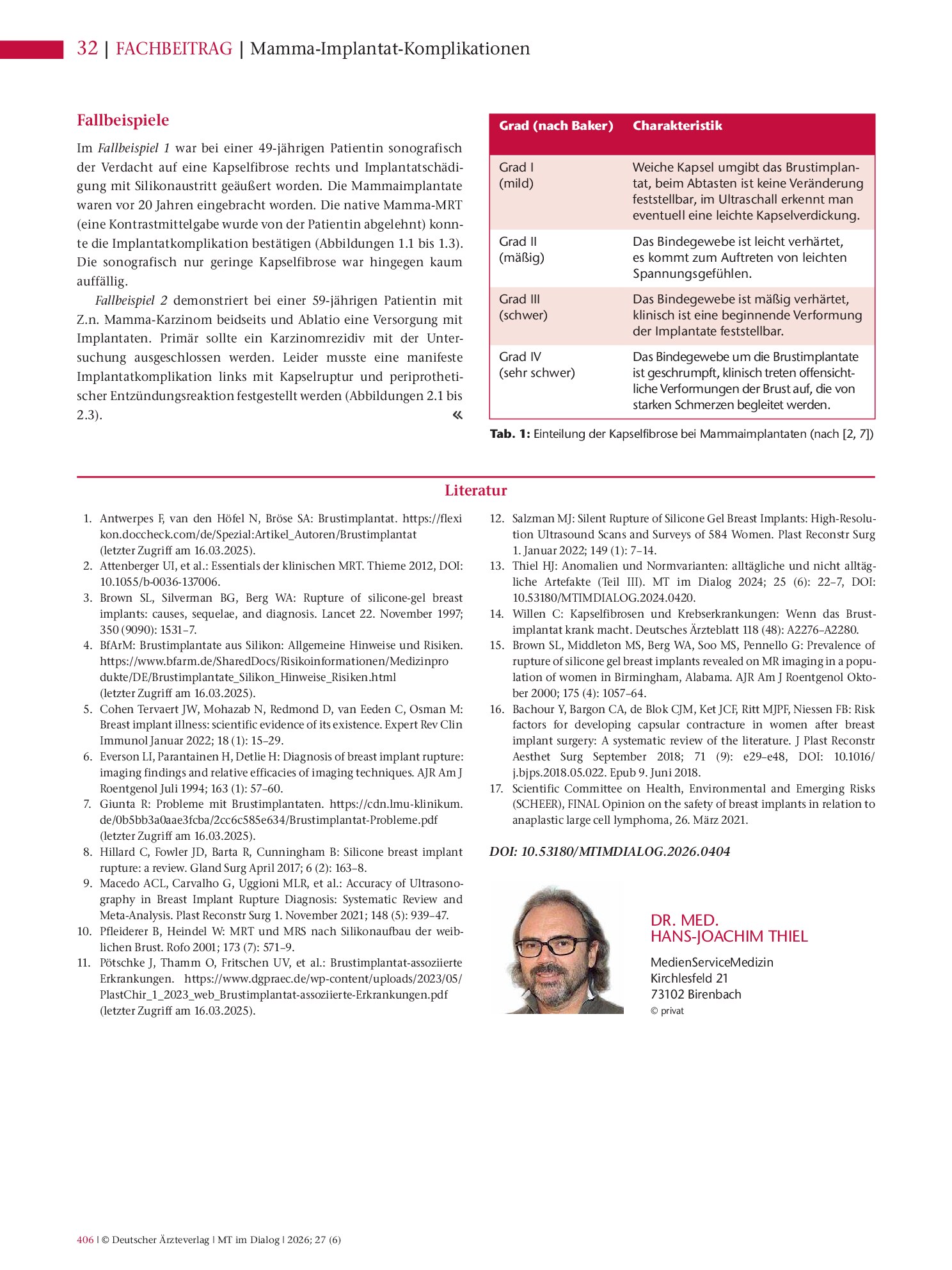 Vorschauseite 3: Anomalien und Normvarianten – Wieder einmal anders (Teil IV): Mamma-Implantat-Komplikationen